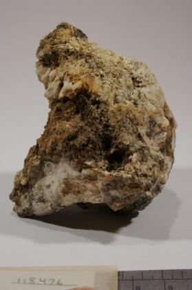 Epididymite
